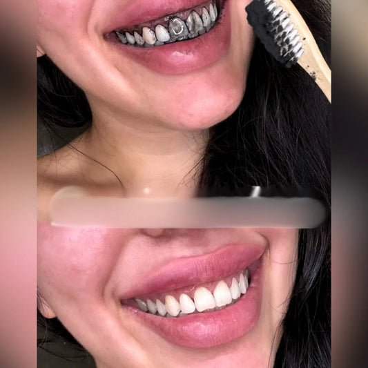 [LIQUIDACIÓN 2X1] Blanqueador Dental Orgánico - Pagas al Recibir